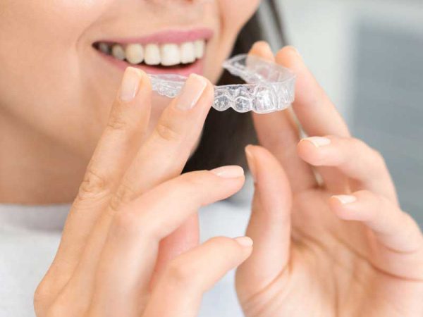 Dental Braces in Punjabi Bagh