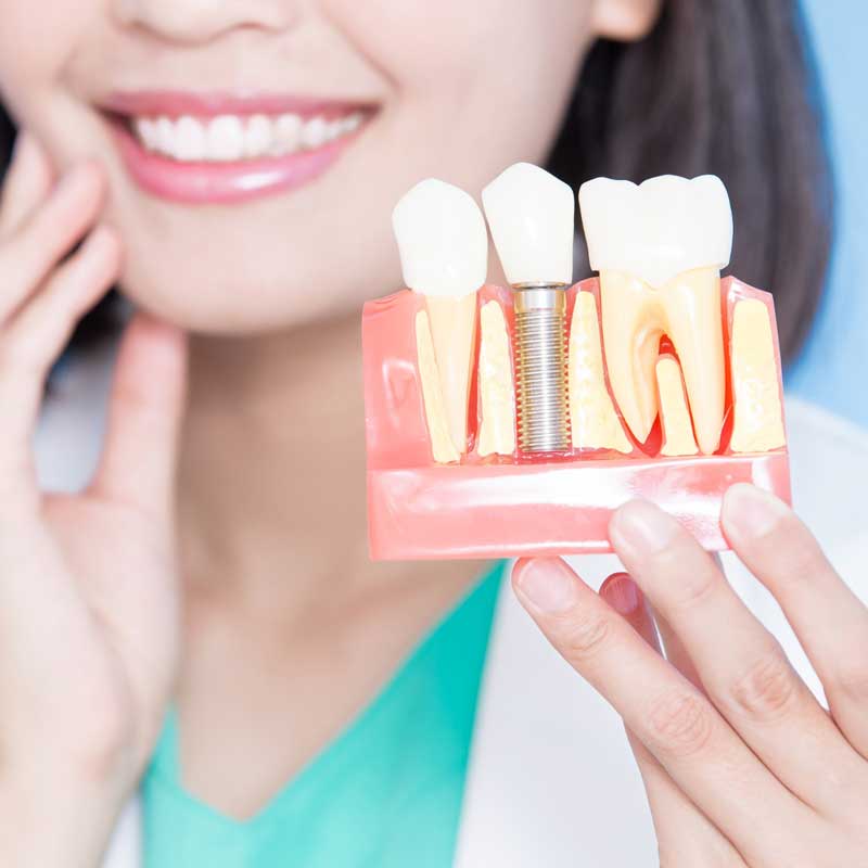 Get Your Smile Back with Multiple Tooth Implants in Punjabi Bagh