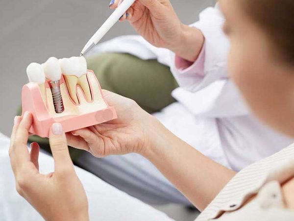 single tooth implants in Delhi