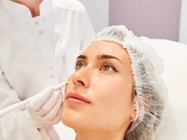 Xanthelasma Treatment in Punjabi Bagh
